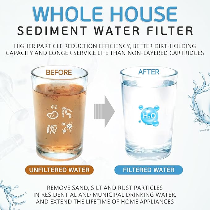 Ronaqua 20" x 4.5" Big Sediment Replacement Water Filter Cartridge, 1 Micron, NSF Certified, for Whole House, Compatible with 155358-43, 2PP20BB1M, AP810-2, FPMB-BB5-20, P5-20BB, SDC-45-2005, 20 Pack